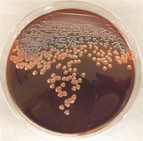 pseudomonas aeruginosa emb
